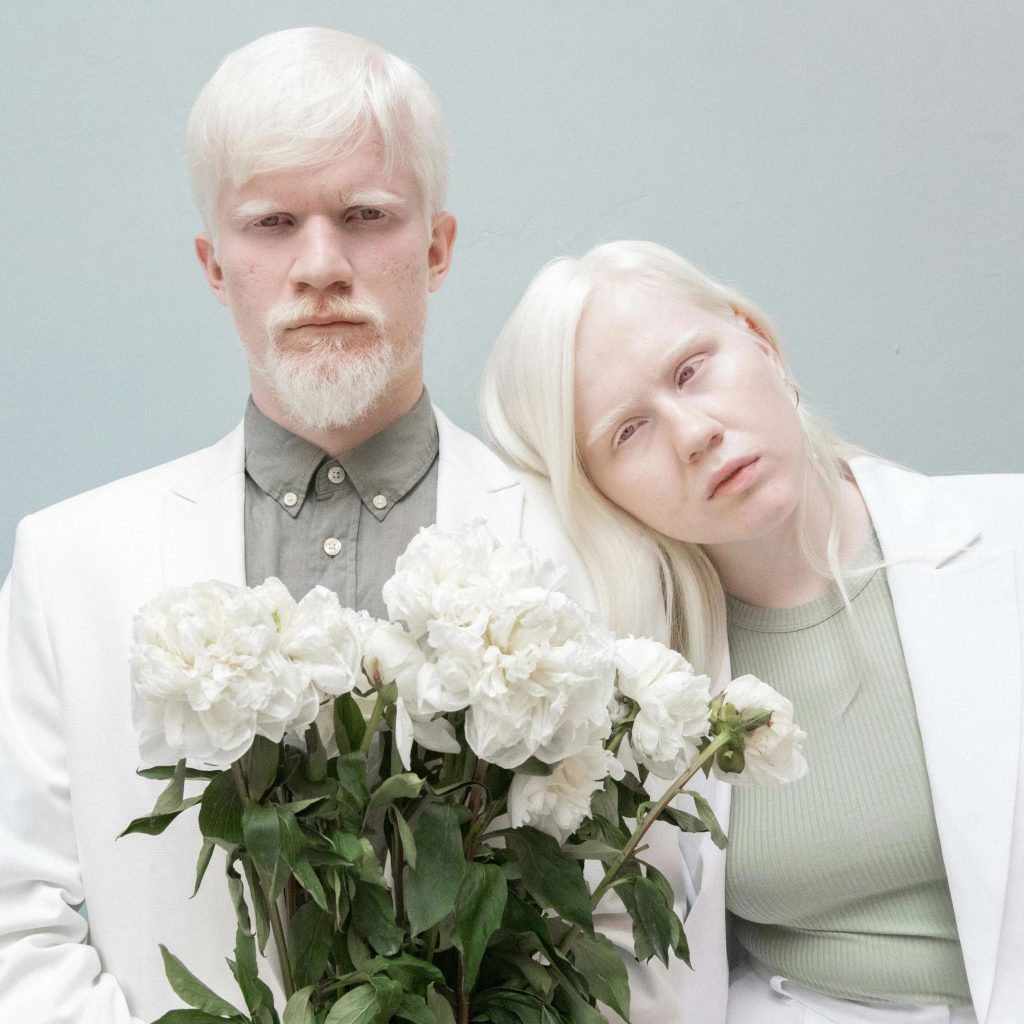 SANTÉ – Journée internationale de sensibilisation à l’albinisme, toujours pas de traitement pour cette maladie rare